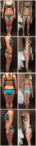 Danille Side By Side Transformation (March 2016)